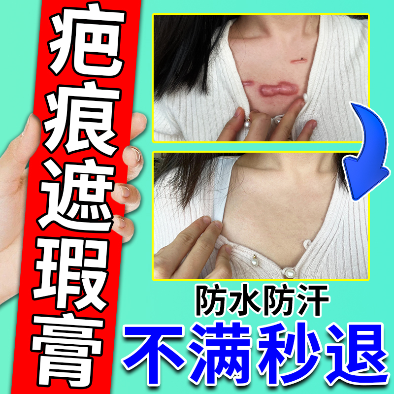 Concealer for Covering Bumpy Scars, Surgical Scars, Neck, Armpit, Arm Scars, Tattoo and Birthmark Lightening Liquid Concealer for Covering Bumpy Scars, Surgical Scars, Neck, Armpit, Arm Scars, Tattoo and Birthmark Lightening Liquid