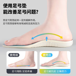평평한 발을위한 특수 치열 교정 삽입, 성인 XO 다리 valgus orthotic Arch 패드 남성 및 여성 충격 흡수에 대한 아치 지원