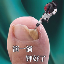 (Watson’s hot sale) One drop of it inhibits bacteria without removing nails removes 99% of gray potassium fungi and guarantees refund if ineffective.