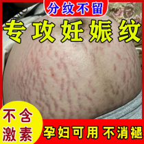 Growth mark repair cream stretch mark elimination and lightening stretch mark removal postpartum repair cream skin tightening scar repair