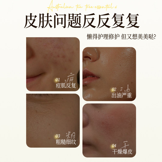 Tea tree essential oil to remove acne marks and repair Facial soothing Facial oil to control acne removal plant Australian acne removal essence oil