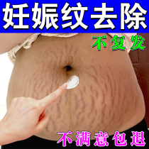 Postpartum elimination of stretch marks firming belly elimination of fat lines growth marks on thighs special repair cream for students to fade