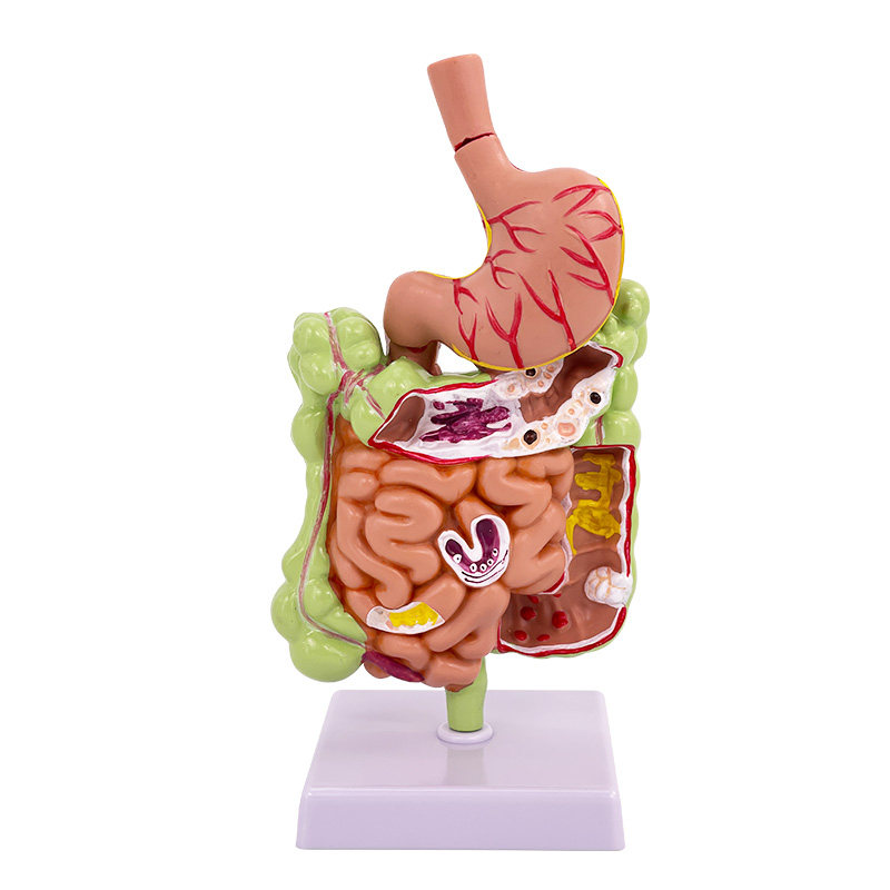 Human Digestive System Anatomy Model Large Intestine Model Rectum Duodenum Internal Organs Gastrointestinal Anatomy Structure Model