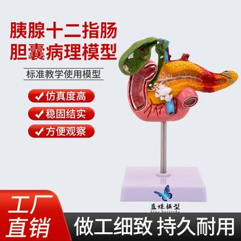 Teaching Simulation Model of Human Pancreas, Duodenum, Gallbladder Pathology, Gallstone Surgery, Digestive System Teaching Aids
