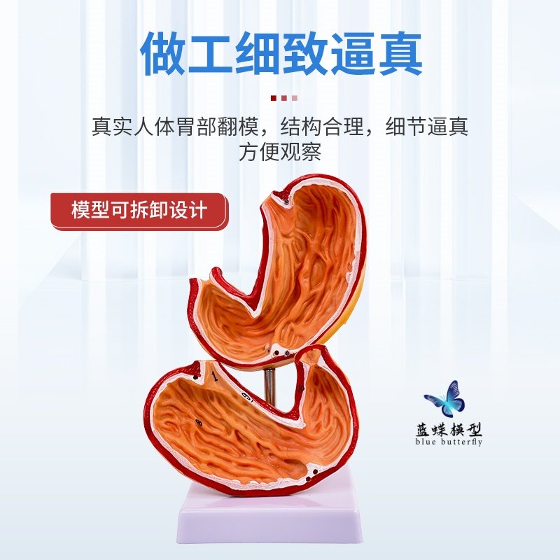 Human Stomach Anatomy Model, Stomach Lesion Model, Stomach Disease Demonstration Model, Pathological Stomach, Gastric Perforation