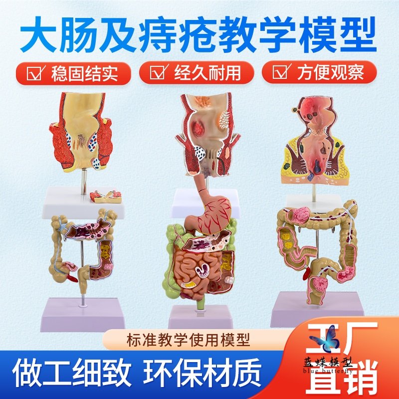 Human Digestive System Anatomy Model Large Intestine Model Rectum Duodenum Internal Organs Gastrointestinal Anatomy Structure Model