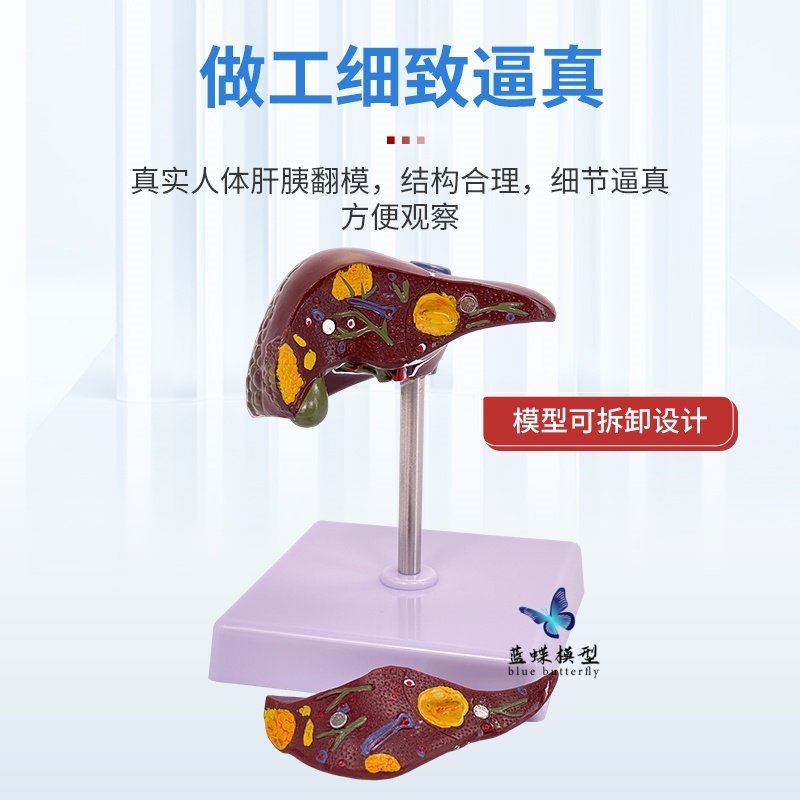 Teaching Simulation Model of Liver, Gallbladder, Pancreas, and Duodenum Structure, Digestive System Medical Liver, Pancreas, and Gallbladder Model