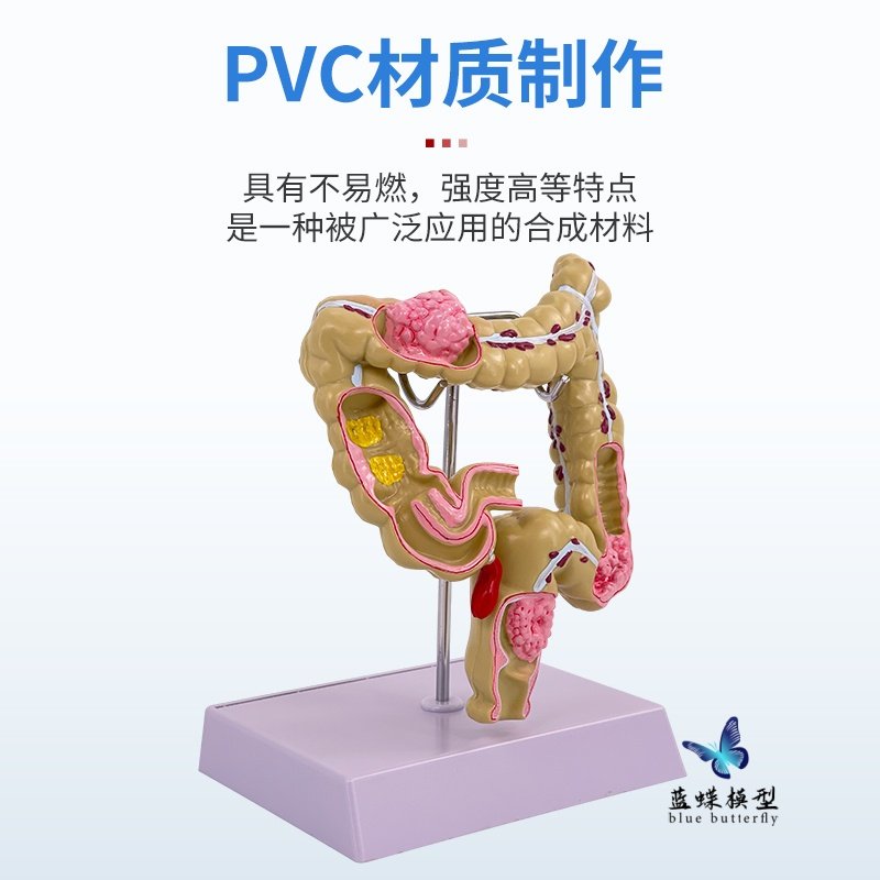 Human Digestive System Anatomy Model Large Intestine Model Rectum Duodenum Internal Organs Gastrointestinal Anatomy Structure Model