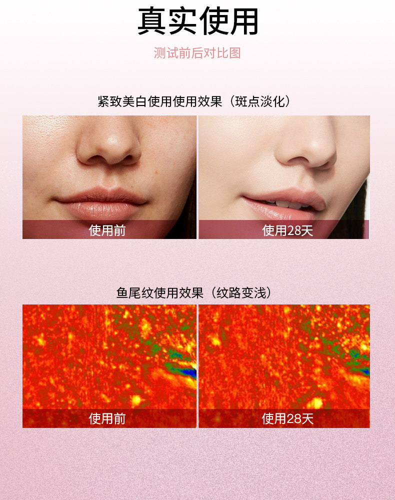 CARYA科光研粉色大排灯三折叠全身美白光疗光子嫩肤家用美容仪 CARYA科光研粉色大排灯三折叠全身美白光疗光子嫩肤家用美容仪
