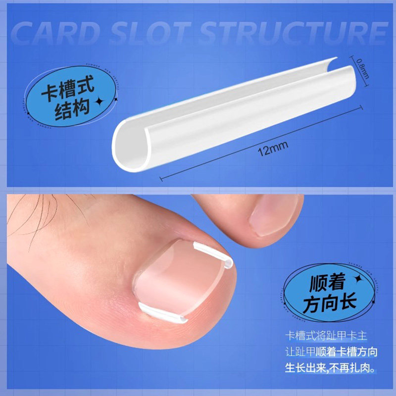 告别疼痛！脚指甲往肉里长？这个神器让你轻松搞定