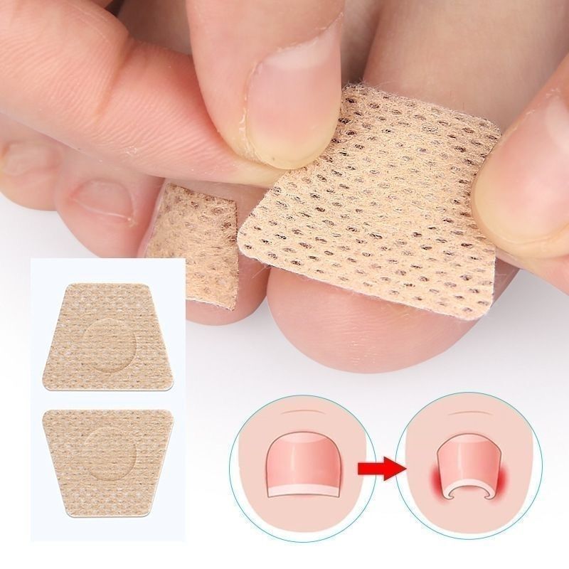 Nail Protection Stickers for Onychomycosis, Nail Protection Patches for Hands and Feet, Protection Patches for Hollow Nails, Damaged Nails, and Paronychia Nail Protection Stickers for Onychomycosis, Nail Protection Patches for Hands and Feet, Protection Patches for Hollow Nails, Damaged Nails, and Paronychia