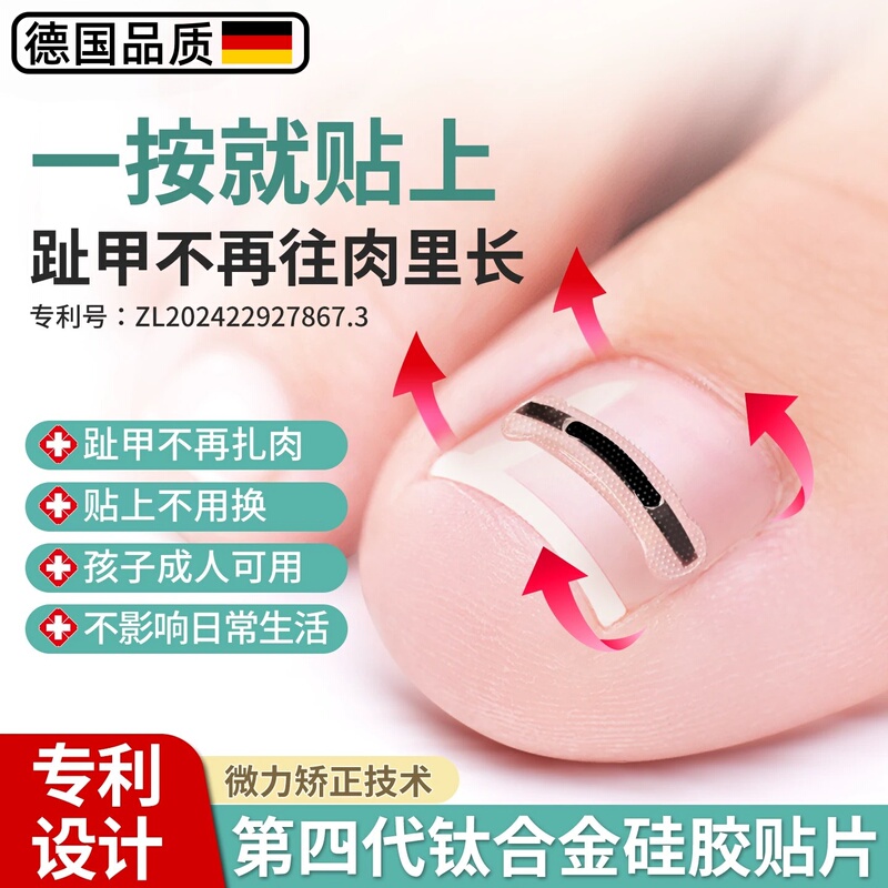 Germany's New Ingrown Toenail Corrector, Specialized Patch for Correcting Toenails That Are Pressing Against the Flesh Germany's New Ingrown Toenail Corrector, Specialized Patch for Correcting Toenails That Are Pressing Against the Flesh