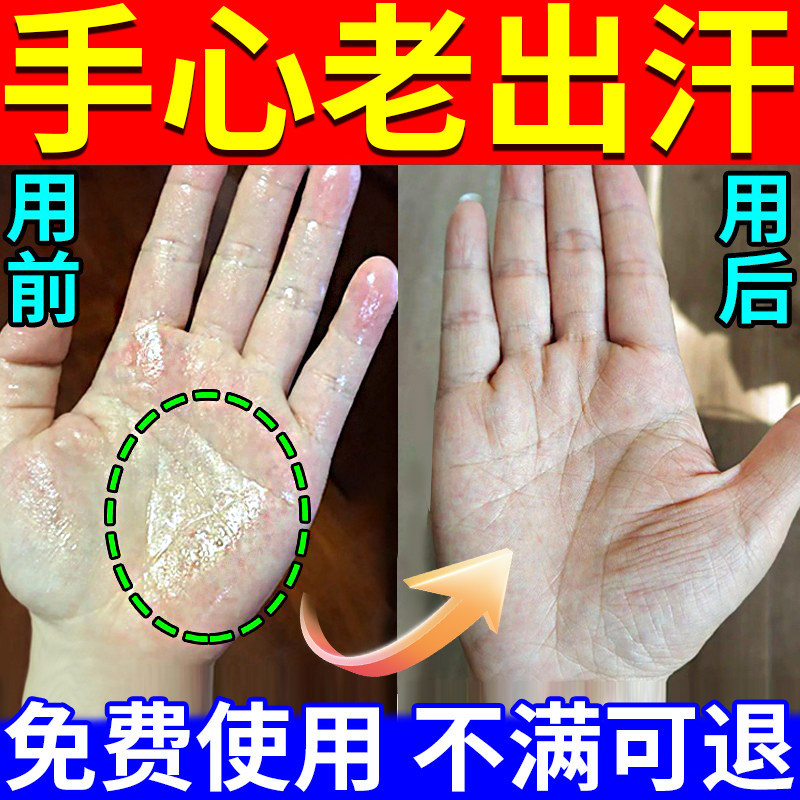 Anti-Perspirant Spray for Hand Sweat Syndrome, Specifically Designed for Dry Hands and Palms, Excessive Sweating, and Wet Palms Anti-Perspirant Spray for Hand Sweat Syndrome, Specifically Designed for Dry Hands and Palms, Excessive Sweating, and Wet Palms