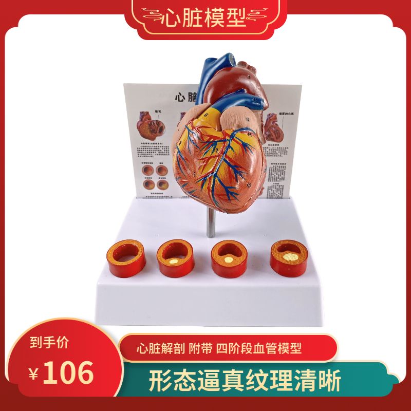 人体心脏模型四阶段血栓可拆卸冠状动脉心血管血液循环解剖器官