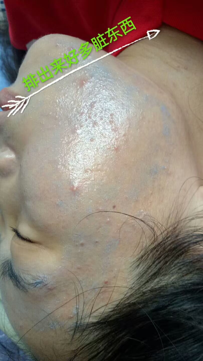 Xác thực đờm kem làm sạch lỗ chân lông rác làm đẹp chăm sóc da tẩy trang kem massage mặt màu đỏ với cùng một đoạn kem tẩy trang hàn quốc