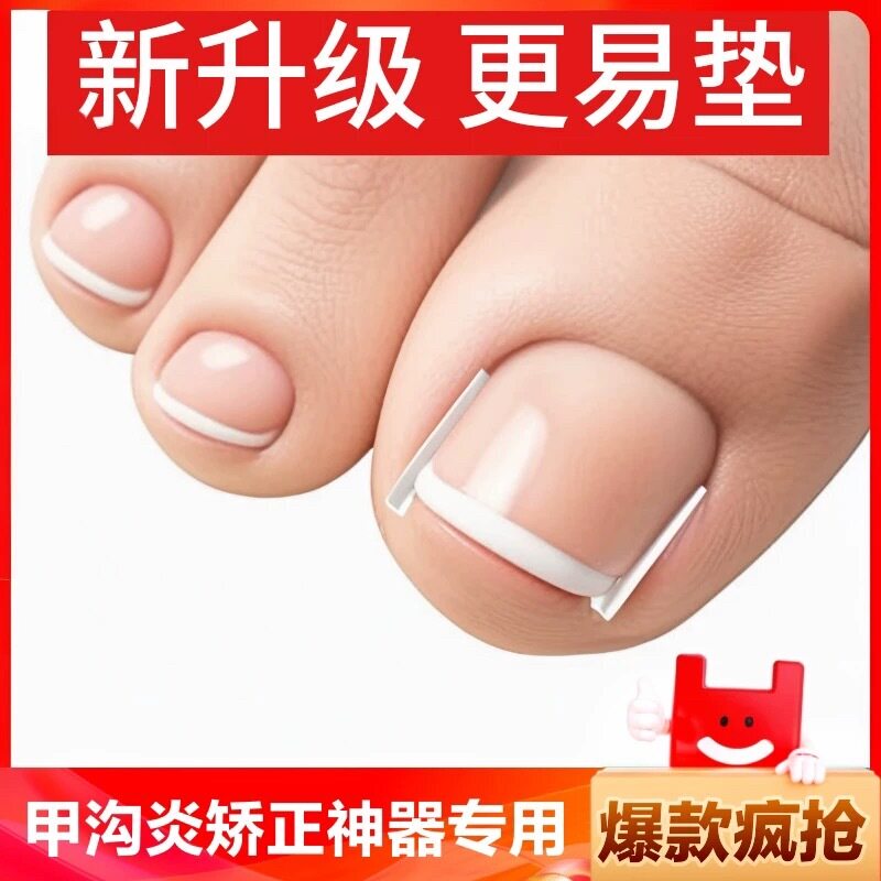 Nail Groove Corrector Filling Pad, Ingrown Toenail Remedy, Specialized Treatment Tool Patch to Prevent Toenails from Growing into the Flesh