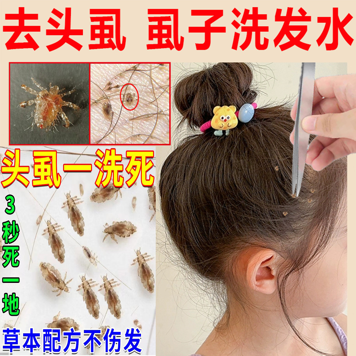 红黑榜实测】野然青去虱洗发水，专治顽固头虱不靠运气！_洗发水_淘宝美妆网, image size:1440x1440