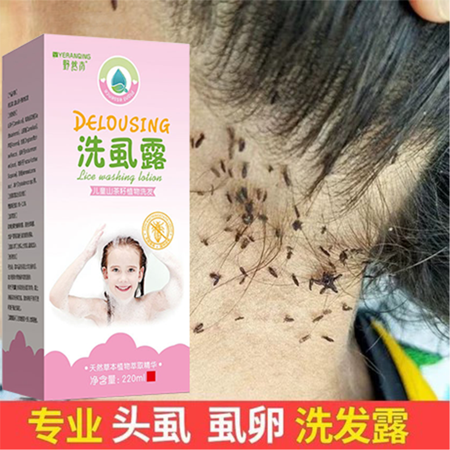 红黑榜实测】野然青去虱洗发水，专治顽固头虱不靠运气！_洗发水_淘宝美妆网, image size:1440x1440
