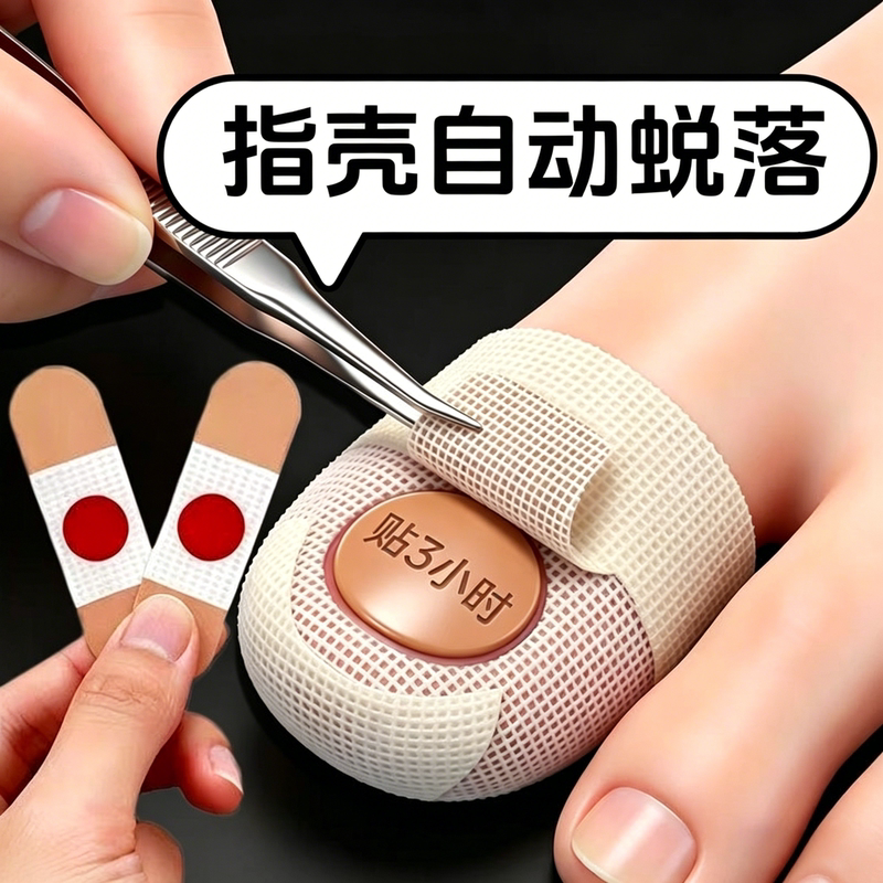 [Hot-Selling Chinese Medicine Product] Herbal Plant Extract Nail Stickers, Genuine Product, Specially Designed for Damaged Hands and Toes, Suitable for Both Men and Women