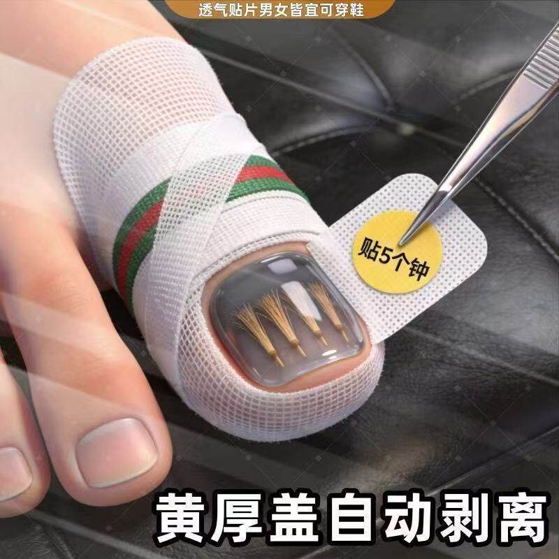 [Same-Day Shipping] Herbal Extract Toenail and Fingernail Patches, Genuine Product, Suitable for Both Men and Women