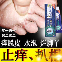 Special ointment for feet itching and rotten moss to remove roots and relieve itching feet blisters type beriberi smelly feet toes itching