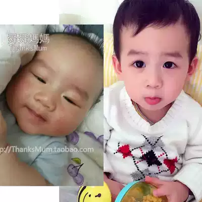 Shun Shun mother Hong Kong pediatricians recommend infants and young children wet~ 3 rash milk ringworm cream cream hormone-free skin