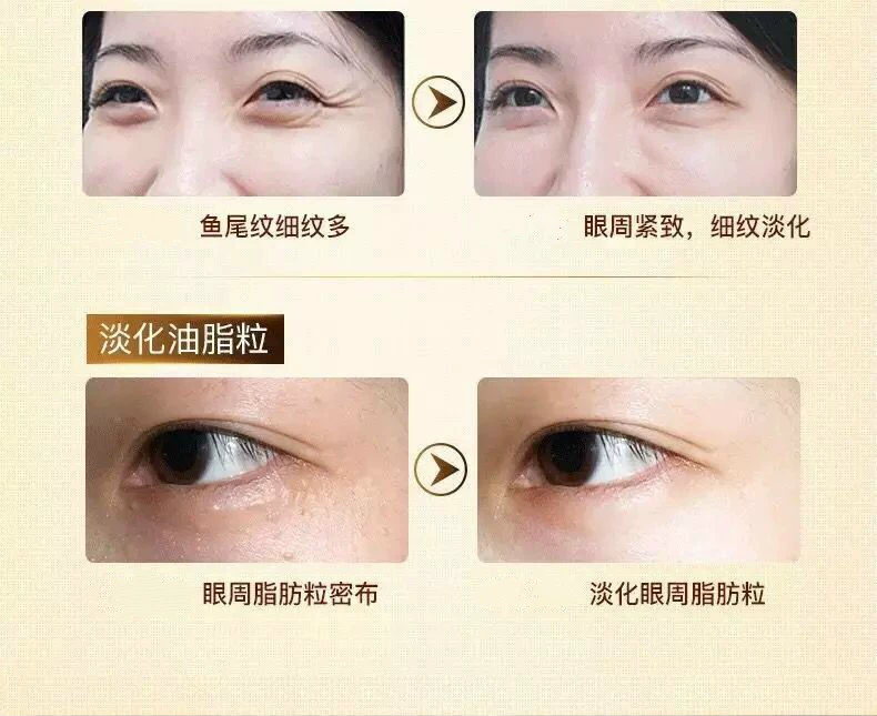 Jinsi Yuxi Gold Eye Care Muscle Liquid Eye Cream Lifting Firming Desalination Eyes Eye Bag Black Eyes