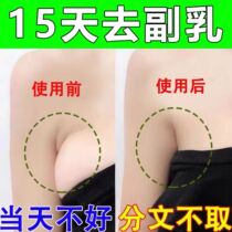 Auxiliary milk elimination paste to remove auxiliary breast artifact (special smelting) lymph node Zhongda dredging and detoxification special plaster under the armpit