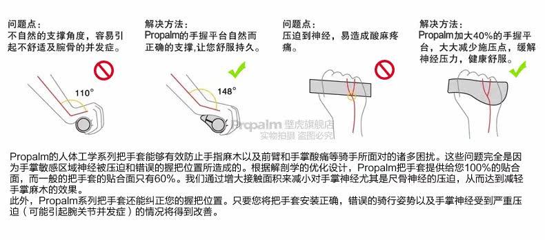 Poignées de vélo PROPALM - Ref 2334724 Image 10