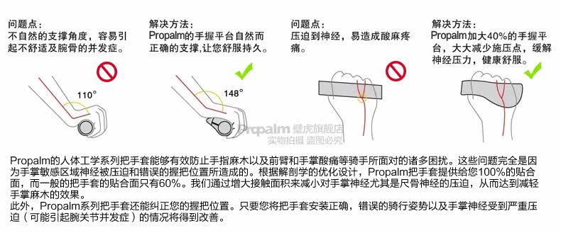 Poignées de vélo PROPALM - Ref 2349926 Image 9