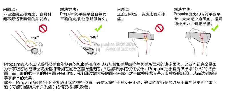 Poignées de vélo PROPALM - Ref 2354042 Image 7