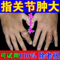 Finger joints deformed swollen thick gout new version of the special medicine to eliminate crystal stiffness and reduce uric acid special paste artifact