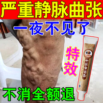 Varicose veins ointment earthworm leg blue tendon raised elastic stockings treater foot soreness external cold compress gel