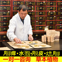 Directly to the root itching peeling and rotten feet - Cai Yimin’s inherited recipe