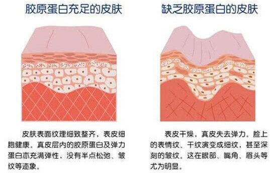 唤醒桃花肌，干皮星人抗皱就要这样做4