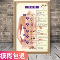 Back Meridian Point Map Back Diagnosis Map Acupuncture Body Meridian Point Traditional Chinese Medicine Health and Beauty Hospital Health and Beauty Pavilion Wall Chart