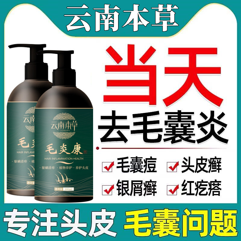 Scalp hair follicles to remove mites dandruff inflammation amino acid shampoo dew to remove mites, dandruff, itching and oil control cleaning artifact