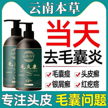 Scalp hair follicles de-mite dandruff dandruff amino acid shampoo dew remove mite anti-dandruff anti-itch control oil cleaning artifact