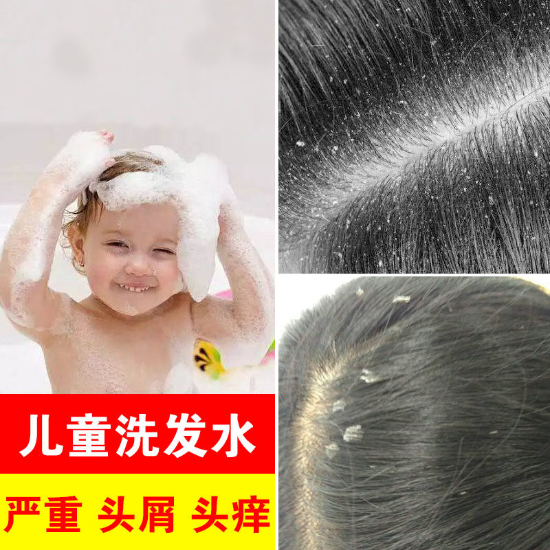 Children shampoo to dandruff Dandruff Dandruff dedicate mite cliffles 6-12-year 12 old male girl special