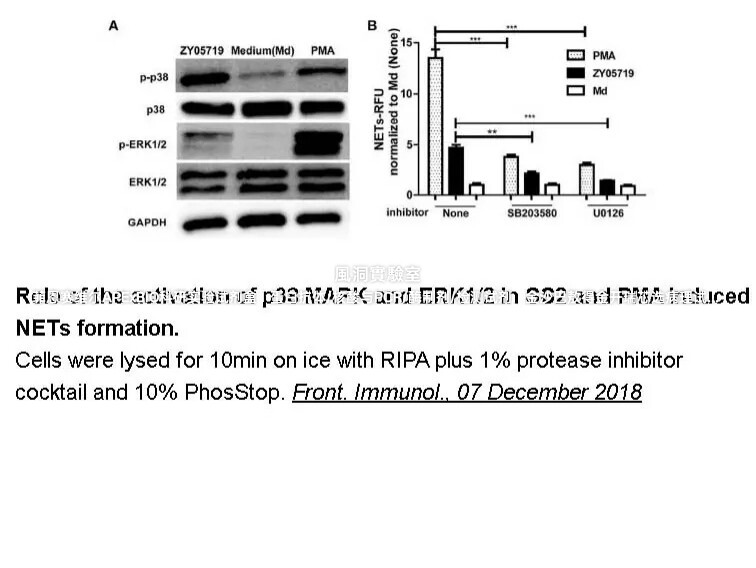 APExBIO蛋白酶抑制剂混合液100X(无EDTA溶DMSO)相当于Sigma P8849