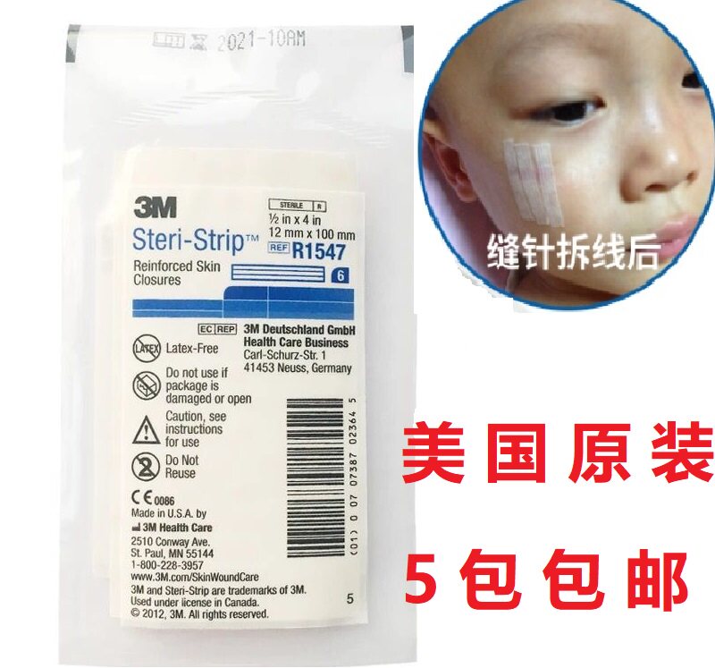 American tension reduction tape fixing tape reduction posting prevents wound widening and widening hypertrophic depression