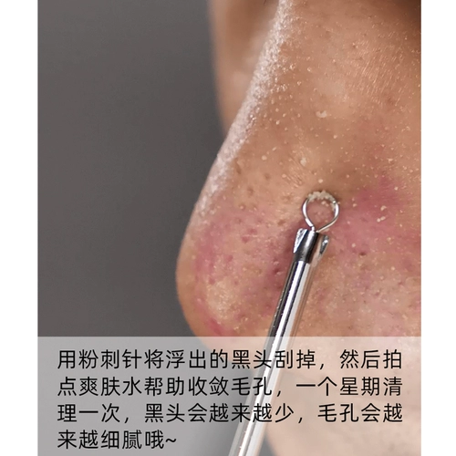 Жидкость для экспорта черных точек, закрытая вода от прыщей, удаление черных точек, сужение пор, специальная корейская линия для салонов красоты с маленькими пузырьками