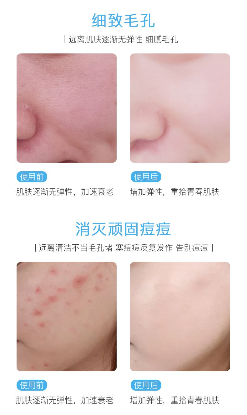 Tinh chất chuyên dụng vi tinh thể chính hãng làm mờ sương độc tố mỹ phẩm làm sạch da cân bằng kem massage nuôi dưỡng guốc - Kem massage mặt kem tay trang