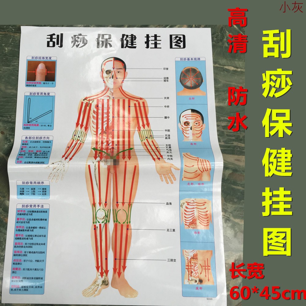 保健养身馆刮痧图刮痧教学挂图贴图全身刮痧穴位图头部身刮痧线路