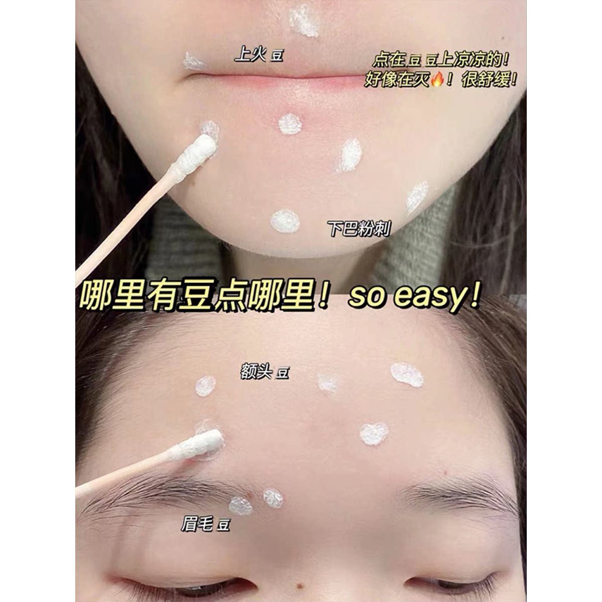 精准拿捏突发豆！2.0大水滴3点精华液淡化去除痘印修护痘疤10g，敏感肌能用吗？_液态精华_淘宝美妆网