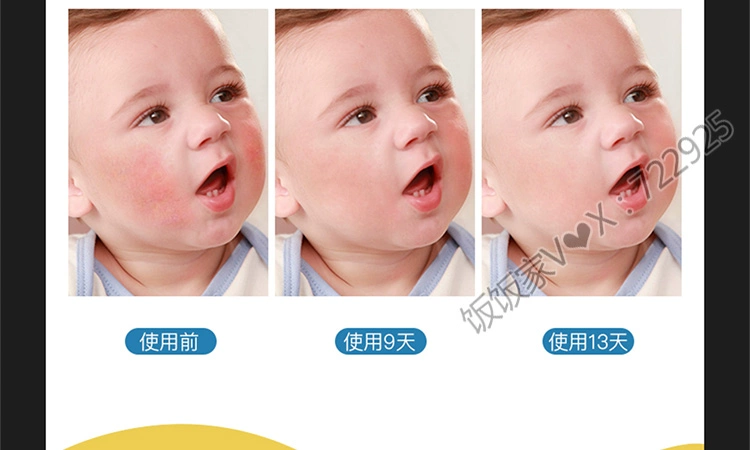 Kem dưỡng da dành cho trẻ em của Ke Yan 200ml Kem dưỡng ẩm da mặt cho trẻ em - Kem dưỡng da