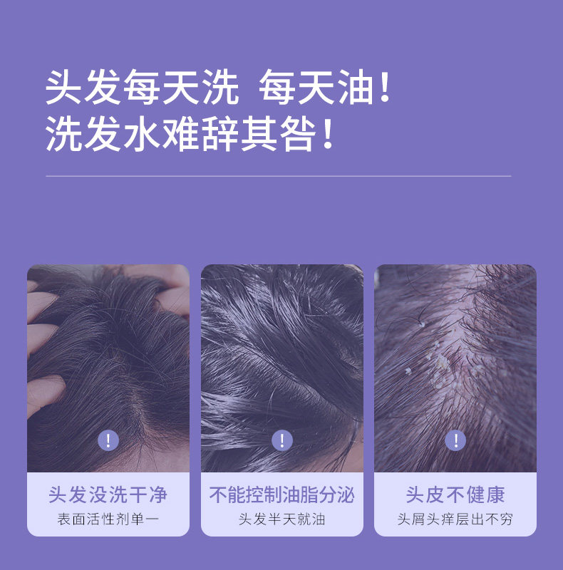 美国Belli氨基酸控油洗发水去屑备孕妇女洗头膏洗护露用品专用 — 8