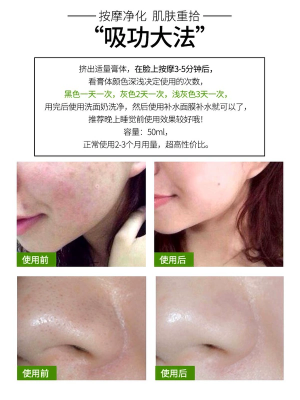 Trang web chính thức vốn tinh khiết cỏ thanh lọc làm sạch sâu mặt kem làm sạch lỗ chân lông hàng độc tố trên khuôn mặt nam giới và phụ nữ kem massage - Kem massage mặt
