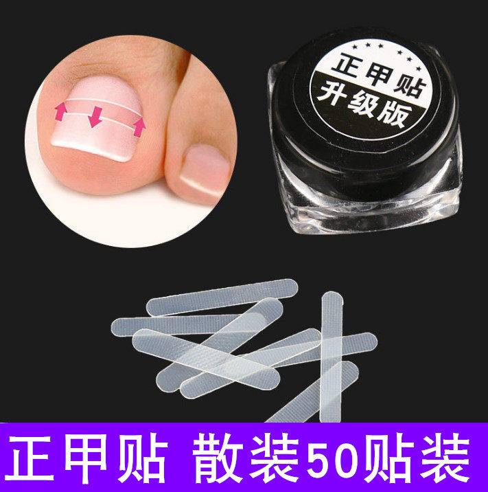 Orthocarpment groove inlay orthosis toenail pull nail straighten nail orthopedic corrective embedded special patch bulk