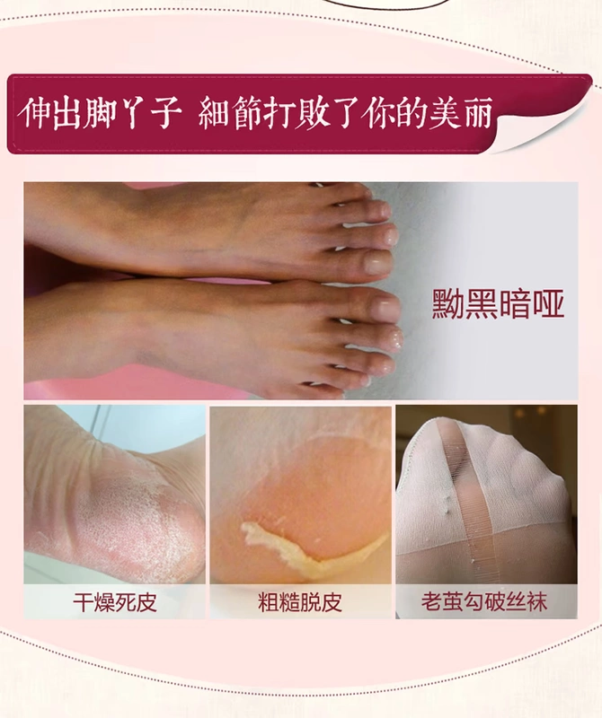 Sáp tử cung ban ngày nuôi dưỡng chân sáp để loại bỏ da bong tróc chân mềm mại chăm sóc chân để đi đến mặt nạ chân sừng cũ
